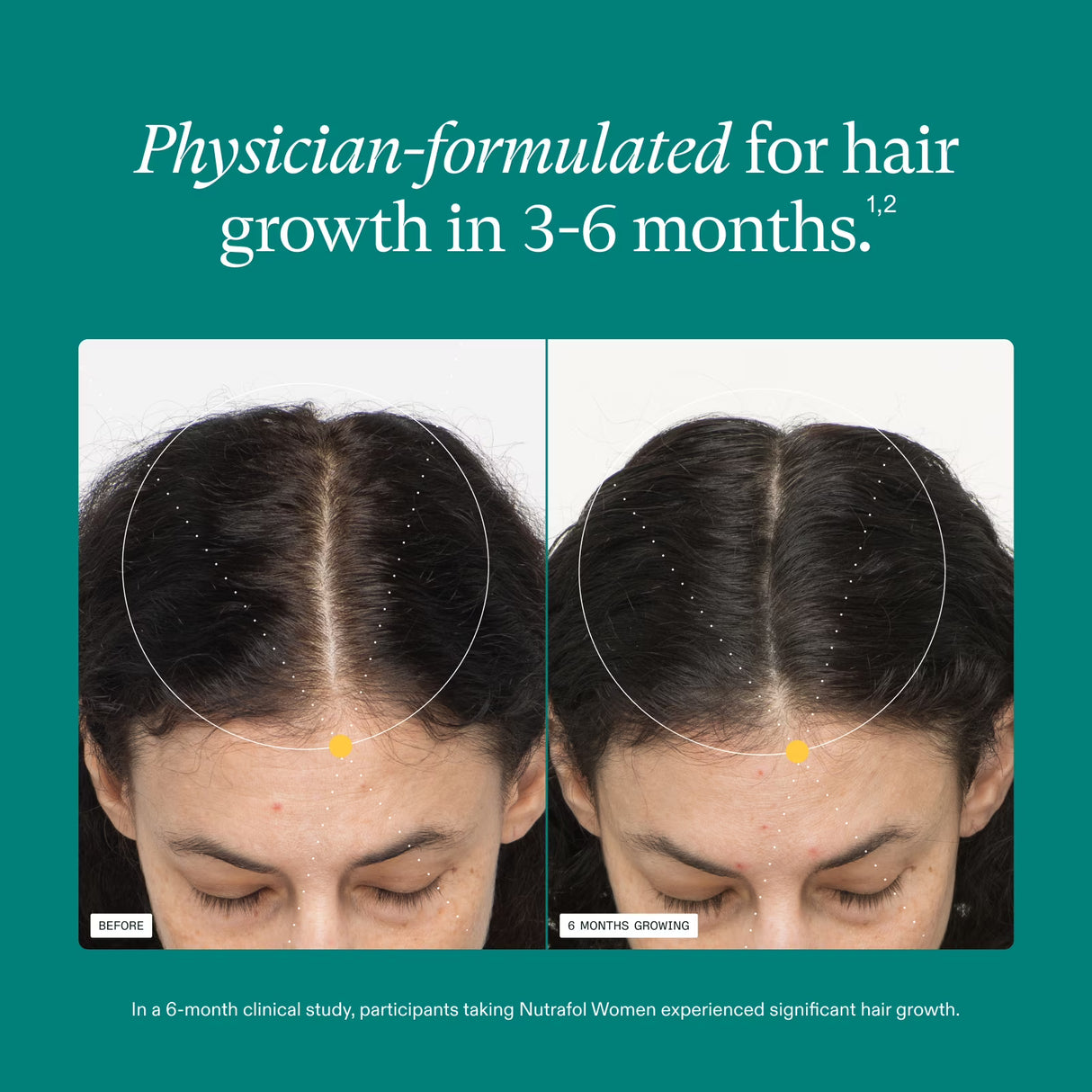 Nutrafol Women's Hair Growth Supplements, Ages 18-44